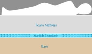 Graphic with 4 layers. Bottom layer is titled Base, second layer is titled Starfish Comforts, third layer is titled Foam Mattress, top layer has a profile of a sleeping person.